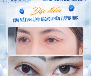 Cắt mí phượng có cải thiện tướng số không