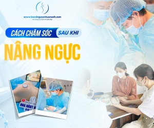 Quy trình nâng ngực tại BVTM Nguyễn Tuấn Anh