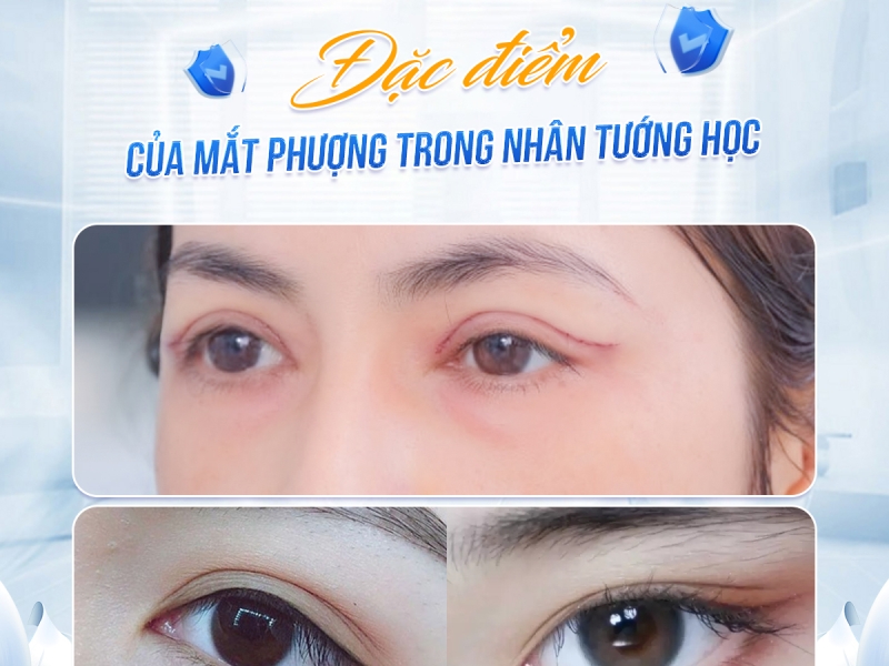 Cắt mí phượng có cải thiện tướng số không