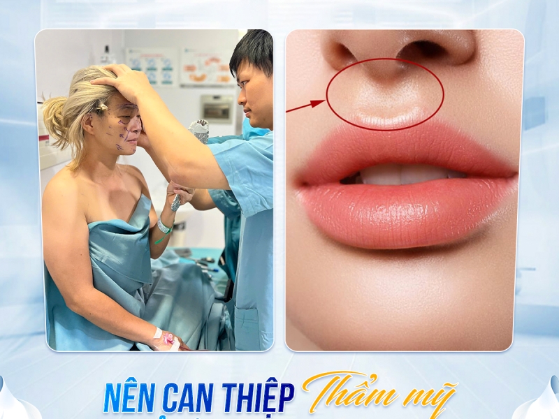 Nhân trung sâu dài nói lên điều gì