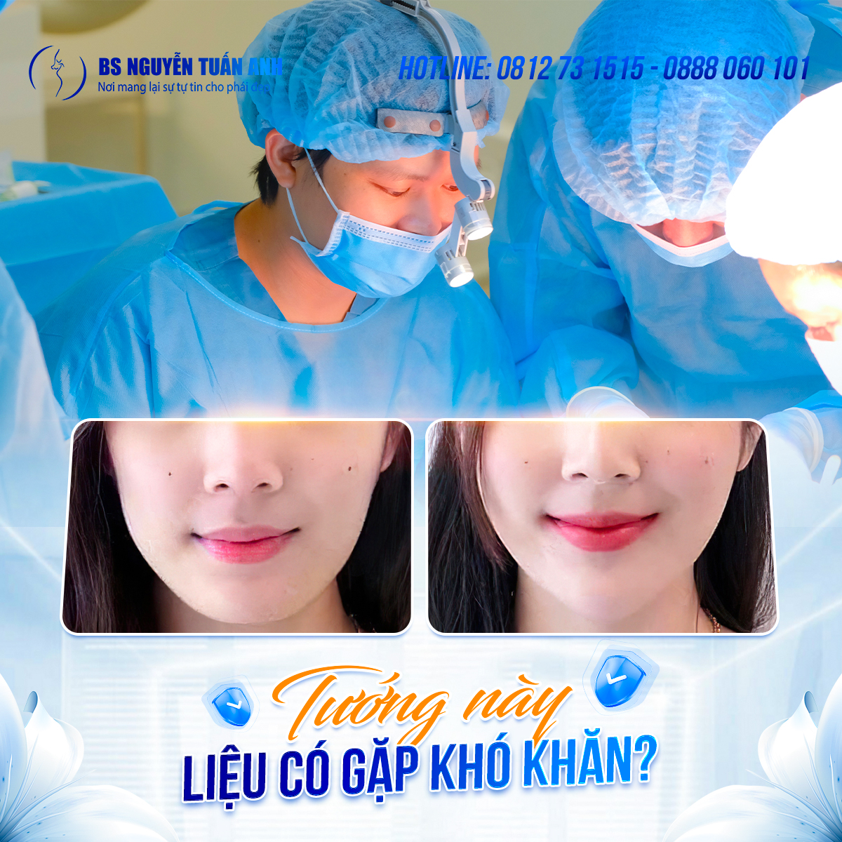 Má đầy đặn là người như thế nào